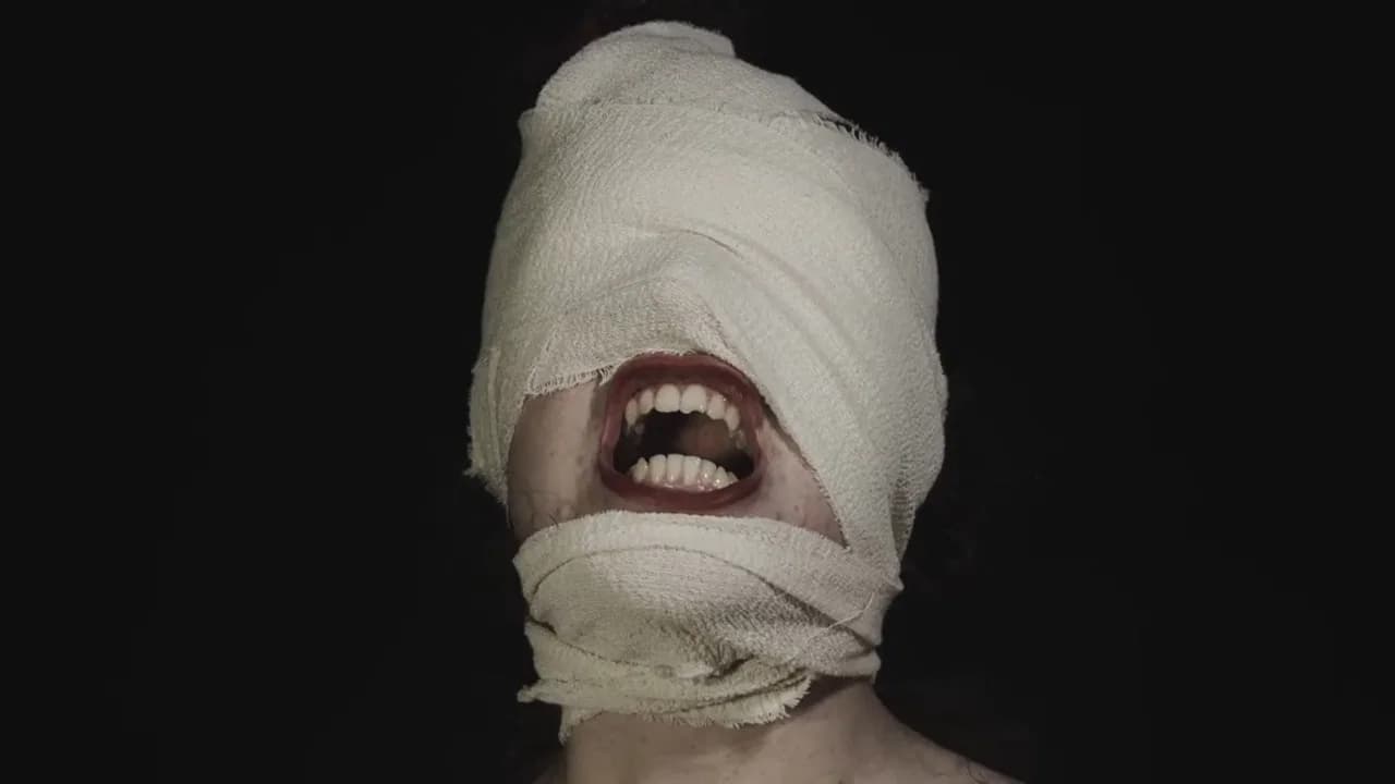 The Bite